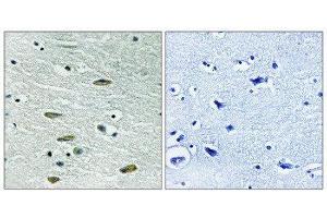 Immunohistochemistry (IHC) image for anti-Insulin-Like Growth Factor 1 Receptor (IGF1R) (Tyr1346) antibody (ABIN1848190) (IGF1R 抗体  (Tyr1346))