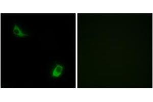 Immunofluorescence analysis of LOVO cells, using FPRL2 Antibody. (FPR3 抗体  (AA 304-353))