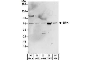 Western Blotting (WB) image for anti-Death-Associated Protein Kinase 3 (DAPK3) (AA 1-50) antibody (ABIN7452996)