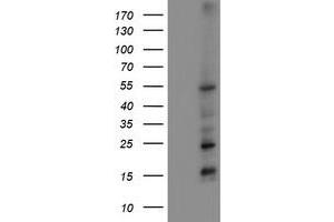 Western Blotting (WB) image for anti-Myocyte Enhancer Factor 2C (MEF2C) antibody (ABIN1499366) (MEF2C 抗体)