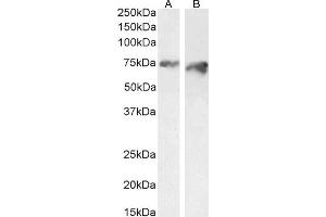 ABIN570954 (2 μg/mL) staining of HeLa (A) and (1 μg/mL) of HepG2 (B) cell lysate (35 μg protein in RIPA buffer). (PCSK9 抗体  (AA 214-228))