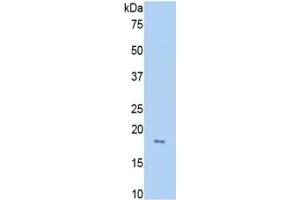 Western Blotting (WB) image for Hemopexin (HPX) ELISA Kit (ABIN6730985)