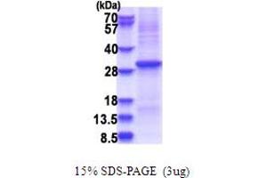 Kallikrein 10 Protein (KLK10) (AA 34-276) (His tag)