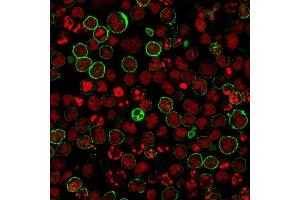 anti-Membrane-Spanning 4-Domains, Subfamily A, Member 1 (MS4A1) antibody