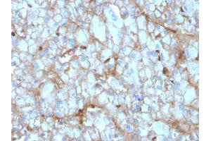 Formalin-fixed, paraffin-embedded human Kidney stained with C1QA Mouse Monoclonal Antibody (C1QA/2954). (C1QA 抗体  (AA 104-237))