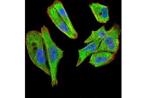 Immunofluorescence (IF) image for anti-Tubulin Folding Cofactor C (TBCC) (AA 1-196) antibody (ABIN5542597)