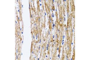 Immunohistochemistry of paraffin-embedded mouse heart using MAP1LC3B antibody. (LC3B 抗体)