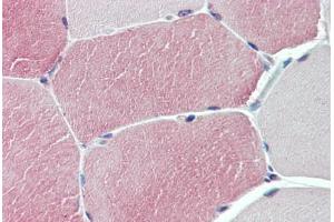 Anti-TXLNB antibody  ABIN1049448 IHC staining of human skeletal muscle. (Taxilin beta 抗体  (Internal Region))