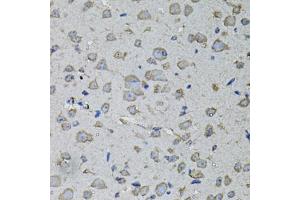 Immunohistochemistry of paraffin-embedded mouse brain using IL1A antibody (ABIN6291332) at dilution of 1:100 (40x lens). (IL1A 抗体)