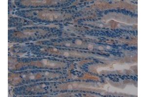 Detection of SIRT2 in Rat Intestine Tissue using Polyclonal Antibody to Sirtuin 2 (SIRT2) (SIRT2 抗体  (AA 28-303))