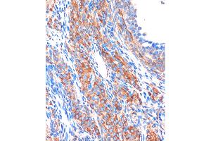 Immunohistochemistry (IHC) image for anti-Zona Pellucida Binding Protein (ZPBP) (AA 45-200) antibody (ABIN7271569)