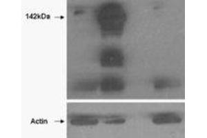 Western Blotting (WB) image for anti-Tankyrase, TRF1-Interacting Ankyrin-Related ADP-Ribose Polymerase (TNKS) (N-Term) antibody (ABIN2464160) (TNKS 抗体  (N-Term))