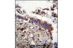 TTBK2 Antibody (N-term) (ABIN656096 and ABIN2845439) immunohistochemistry analysis in formalin fixed and paraffin embedded human lung tissue followed by peroxidase conjugation of the secondary antibody and DAB staining. (TTBK2 抗体  (N-Term))