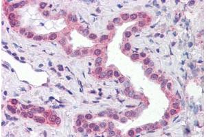 Immunohistochemistry (Formalin-fixed Paraffin-embedded Sections) (IHC (fp)) image for anti-ATP Synthase, H+ Transporting, Mitochondrial F1 Complex, epsilon Subunit (ATP5E) (AA 1-52) antibody (ABIN574212)