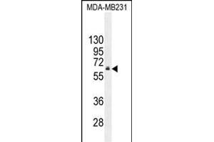 HNF1B Antibody (C-term) (ABIN655066 and ABIN2844696) western blot analysis in MDA-M cell line lysates (35 μg/lane). (HNF1B 抗体  (C-Term))