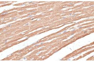 Immunohistochemistry of paraffin-embedded Rat heart using KIF4A Polyclonal Antibody at dilution of 1:100 (40x lens). (KIF4A 抗体)