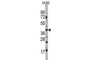 Image no. 1 for anti-POU Class 5 Homeobox 1 (POU5F1) antibody (ABIN357429) (OCT4 抗体)