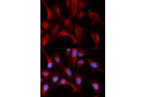 Immunofluorescence analysis of U2OS cells using PSMB4 antibody. (PSMB4 抗体  (AA 1-264))