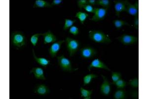 Immunofluorescence staining of A549 cells with ABIN7157651 at 1:200, counter-stained with DAPI. (KIF3C 抗体  (AA 158-267))
