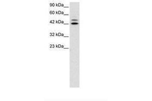 Image no. 3 for anti-Interferon Regulatory Factor 8 (IRF8) (AA 35-84) antibody (ABIN6735806) (IRF8 抗体  (AA 35-84))