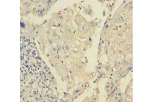 Immunohistochemistry (IHC) image for anti-Transient Receptor Potential Cation Channel, Subfamily M, Member 8 (TRPM8) (AA 1-192) antibody (ABIN7172870)