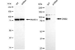 Western blotting analysis using DAB2 antibody (ABIN7798352). (Recombinant DAB2 抗体)
