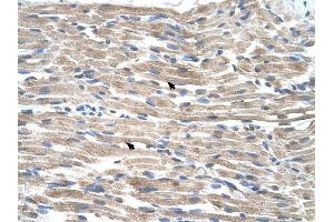 BMP2K antibody was used for immunohistochemistry at a concentration of 4-8 ug/ml to stain Skeletal muscle cells (arrows) in Human Muscle. (BMP2K 抗体  (C-Term))