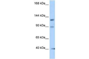 WB Suggested Anti-Ofd1 Antibody Titration: 1. (OFD1 抗体  (N-Term))