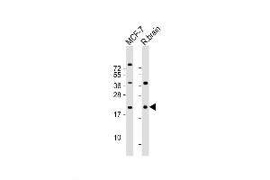 Western Blot at 1:2000 dilution Lane 1: MCF-7 whole cell lysate Lane 2: rat brain lysate Lysates/proteins at 20 ug per lane. (RAC1 抗体  (AA 49-78))