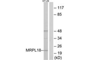 Western blot analysis of extracts from HT-29 cells, using MRPL18 Antibody. (MRPL18 抗体  (AA 1-50))