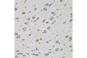 Immunohistochemistry of paraffin-embedded mouse brain using NAPA antibody. (NAPA 抗体)