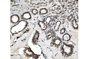 IHC analysis of VPRBP/DCAF1 using anti-VPRBP/DCAF1 antibody (ABIN7599063). (DDB1 and CUL4-Associated Factor 1 (DCAF1) (AA 1-195) 抗体)