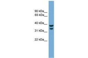 Image no. 1 for anti-Interferon Regulatory Factor 1 (IRF1) (AA 251-300) antibody (ABIN6744534) (IRF1 抗体  (AA 251-300))