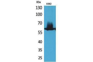 Western Blotting (WB) image for anti-Nuclear Factor-kB p65 (NFkBP65) (Thr743) antibody (ABIN3178367) (NF-kB p65 抗体  (Thr743))