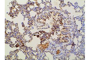 Immunohistochemistry (IHC) image for anti-Phosphoinositide 3 Kinase, p85 alpha (PI3K p85a) (pTyr607) antibody (ABIN6256775)