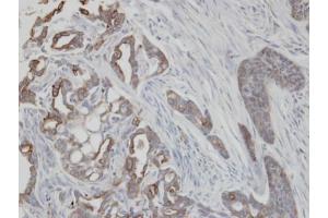 IHC-P Image Immunohistochemical analysis of paraffin-embedded H661 xenograft, using KRT2, antibody at 1:100 dilution. (Keratin 2 抗体)