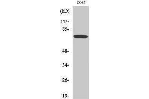 Western Blotting (WB) image for anti-V-Raf-1 Murine Leukemia Viral Oncogene Homolog 1 (RAF1) (pSer259) antibody (ABIN3182138) (RAF1 抗体  (pSer259))