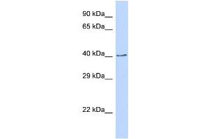Host:  Rabbit  Target Name:  CDS2  Sample Type:  293T Whole cell lysates  Antibody Dilution:  1.