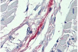 Heart, Human: Formalin-Fixed, Paraffin-Embedded (FFPE) (DDAH2 抗体  (N-Term))