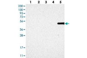 Western blot analysis of Lane 1: RT-4, Lane 2: U-251 MG, Lane 3: Human Plasma, Lane 4: Liver, Lane 5: Tonsil with MFSD6L polyclonal antibody . (MFSD6L 抗体)