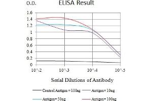Black line: Control Antigen (100 ng),Purple line: Antigen (10 ng), Blue line: Antigen (50 ng), Red line:Antigen (100 ng) (FCRL5 抗体  (AA 16-158))