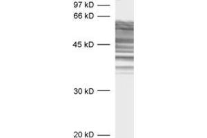Western Blotting (WB) image for anti-tau Protein (AA 3-214) antibody (ABIN1742569) (tau 抗体  (AA 3-214))