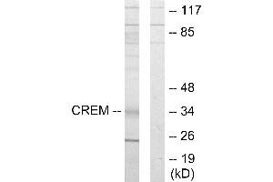 Western blot analysis of extracts from K562 cells, using CREM antibody. (CREM 抗体)