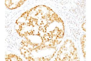 Immunohistochemistry (IHC) image for anti-Excision Repair Cross Complementing Polypeptide-1 (ERCC1) (AA 191-281) antibody (ABIN6939333)