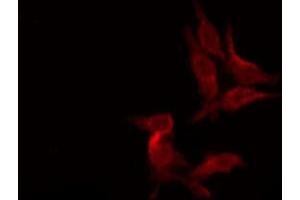 ABIN6276106 staining Hela by IF/ICC. (OPRK1 抗体  (N-Term))