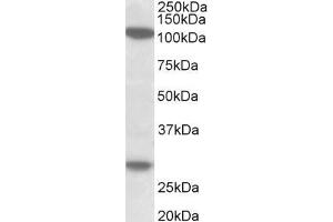 ABIN5539532 (1µg/ml) staining of MOLT4 lysate (35µg protein in RIPA buffer). (Ubinuclein 1 抗体  (Internal Region))