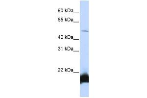 WB Suggested Anti-ONECUT1 Antibody Titration:  0. (ONECUT1 抗体  (N-Term))