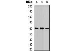 Western blot analysis of PARP3 expression in HEK293T (A), Raw264. (PARP3 抗体  (N-Term))