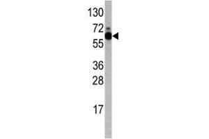Western blot analysis of S6K antibody antibody and Jurkat lysate.