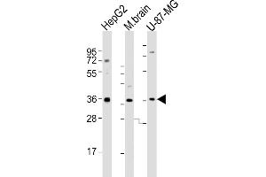 All lanes : Anti-CRYZ Antibody (C-term) at 1:2000 dilution Lane 1: HepG2 whole cell lysates Lane 2: mouse brain lysates Lane 3: U-87-MG whole cell lysates Lysates/proteins at 20 μg per lane. (CRYZ 抗体  (C-Term))